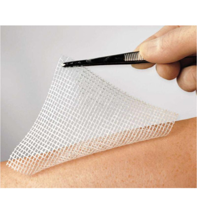 Lomatuell H gaasverband 5 cm x 5 cm (10 stuks)