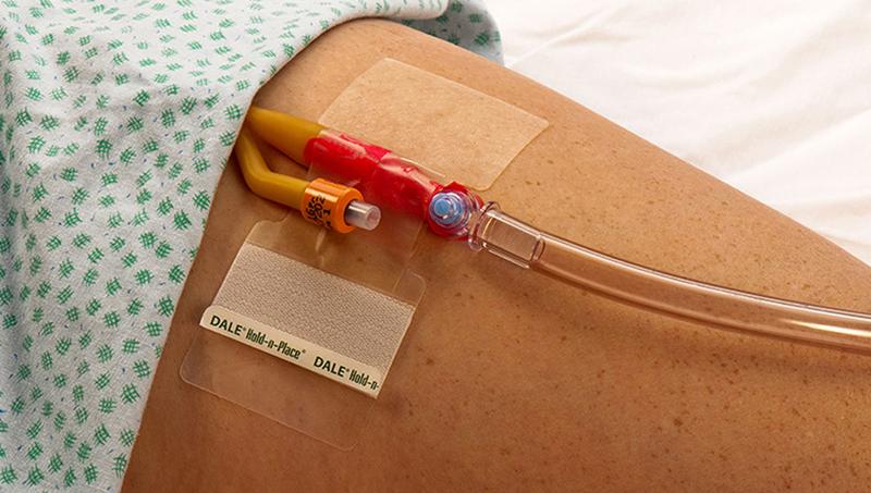 Dale Katheter Fixatiepleister (1 stuk)