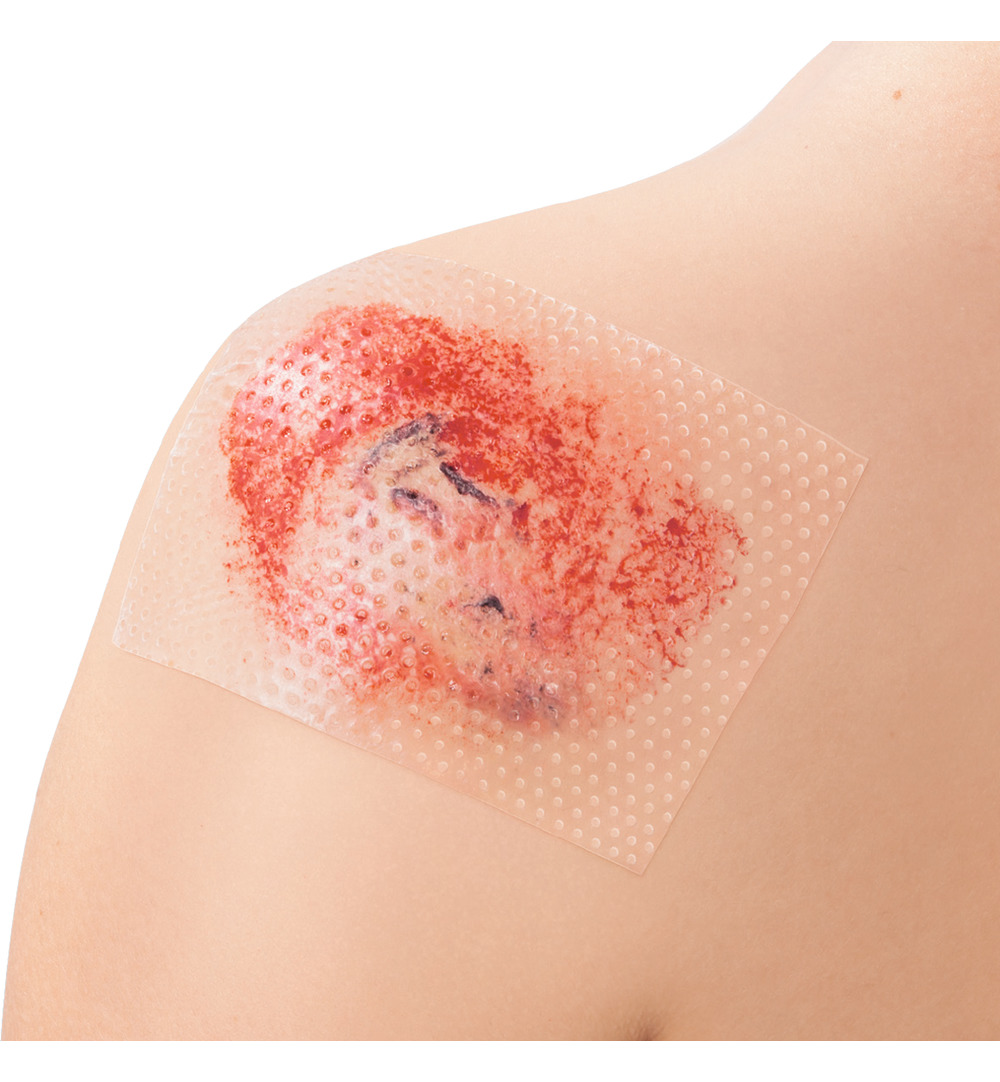 Leukoplast Cuticell Contact 5 x 7,5 cm (5 stuks) - image 2