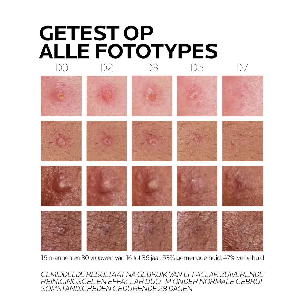 La Roche-Posay Effaclar Duo+m Gel Creme - Anti Imperfections (40 ml) - image 3