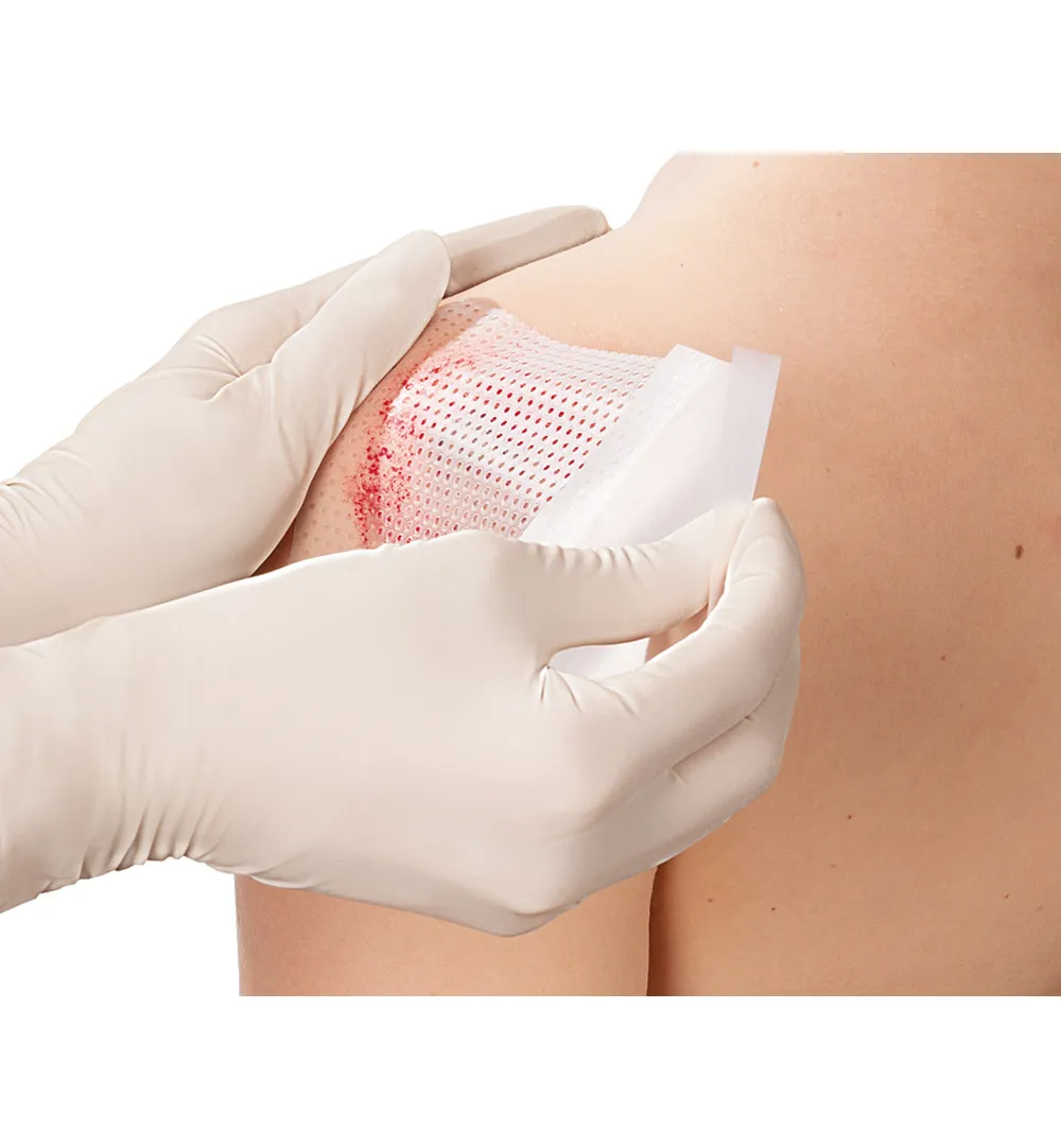 Leukoplast Cuticell Contact 5 x 7,5 cm (5 stuks)