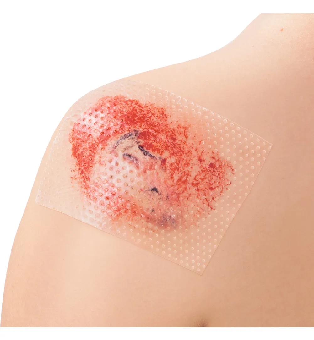 Leukoplast Cuticell Contact 5 x 7,5 cm (5 stuks) - image 2