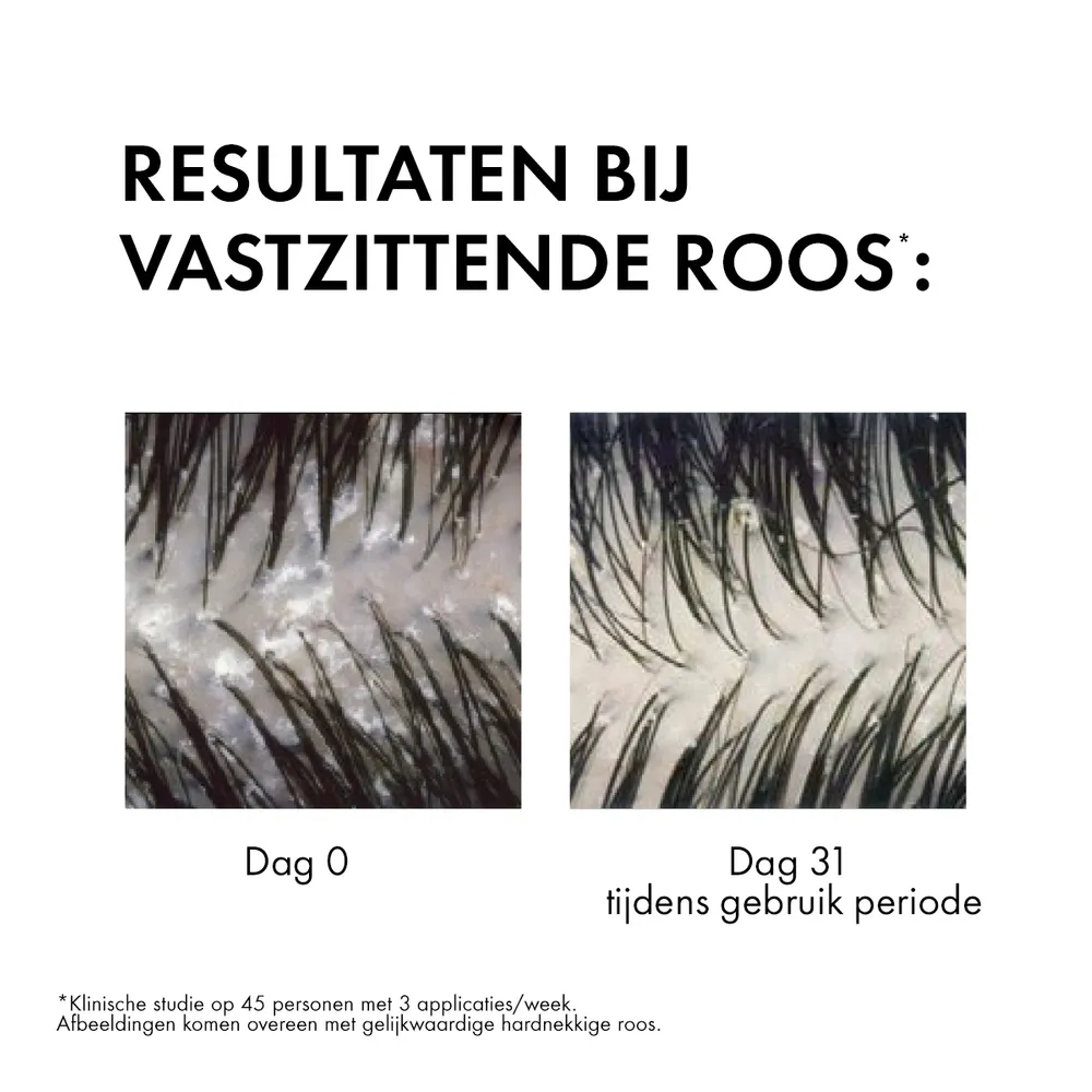 Vichy Dercos Anti-roos Shampoo Normaal tot Vet Haar (200 ml) - image 2